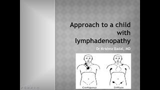 Approach to a child with lymphadenopathy [upl. by Hannej]