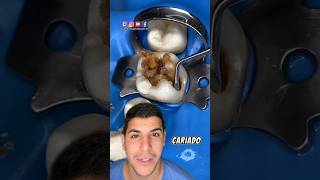 Você já teve dor de dente dentes curiosidades dentista dentesbrancos dicas dentadura [upl. by Assinna]