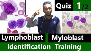 Myeloblast Vs Lymphoblast Identification Training Quiz 12 [upl. by Eytteb]