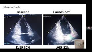 How Carnosine Benefits the Heart [upl. by Alphonse139]