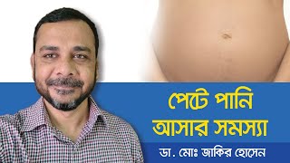 Ascites Treatment  How is ascites treated  পেটে পানি আসলে করণীয়  পেটে পানি জমার লক্ষণ [upl. by Hugibert]