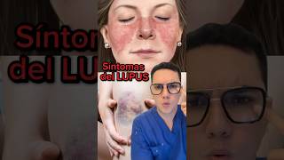 Síntomas de alerta de lupus que no debes ignorar  Dr William Guerrero medicina shorts ￼ [upl. by Haldis]