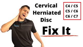 Cervical herniated disc exercises [upl. by Brigid]