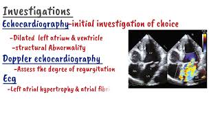 Mitral Regurgitation  Clinical Cardiology [upl. by Aleek]