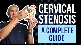 Cervical Spine Stenosis  A Complete Guide [upl. by Wylma391]