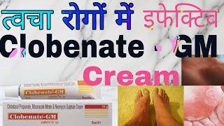 Clobenate  GM Cream Uses in hindi  क्लोबिनेट  जीएम क्रीम के फायदे [upl. by Magna]