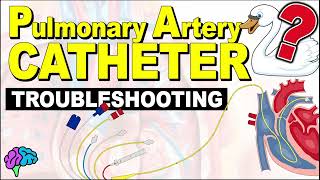 Troubleshooting Your Pulmonary Artery PA Catheter [upl. by Else942]