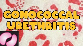 Gonococcal urethritis  Neisseria gonorrhoeae  clinical manifestations  Lab diagnosis [upl. by Venditti]