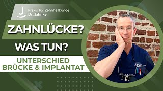 Zahnlücke  Was tun Unterschied Brücke und Implantat  Dr Jahnke [upl. by Atinet]