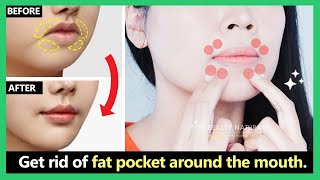 4 mins for Beautiful lips Get rid of perioral mound fat pocket around the mouth [upl. by Alistair4]