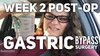 Two Weeks Post Op RNY Gastric Bypass Surgery [upl. by Kellda75]