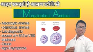 Megaloblastic Anemia medicalentranceexam neetcutoffformedicalcollege preparation pathology [upl. by Aihcats]