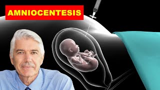 AMNIOCENTESIS MEDICAL DEFINITION OF AMNIOCENTESIS WHAT IS AMNIOCENTESIS [upl. by Ybab]