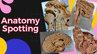 Anatomy spotting for Exam Question Answers [upl. by Notsag]