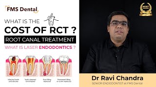 What is the Cost of Root canal Treatment in Hyderabad  Advanced Endodontics  FMS Dental [upl. by Dorina]