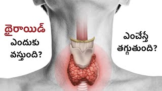 Salt cause Thyroid Problem Natural Treatment for Thyroid Problem [upl. by Nobe]