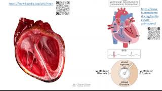 Herz 3 Herzzyklus  Systole und Diastole [upl. by Sucerdor]