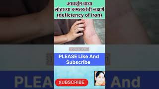 आवर्जून वाचा लोहाच्या कमतरतेची लक्षणेdeficiency of ironshortvideo healthtips viral marathi [upl. by Rutger]