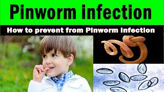 Pinworm infection  How to prevent from Pinworm infection  home remedies  children [upl. by Groome]