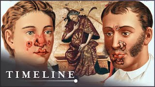 1495 Syphilis Outbreak The Deadly Disease That Swept Across Europe  The Syphilis Enigma  Timeline [upl. by Acemat]