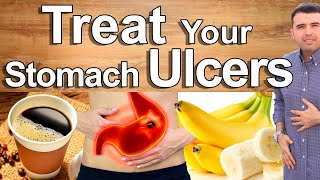 Do This And Cure Your Stomach Pain Gastritis and Ulcers  Best Natural Treatment of Stomach Pain [upl. by Etnecniv901]