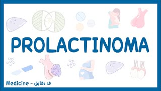 Prolactinoma  definition causes pathophysiology clinical picture investigations amp treatment شرح [upl. by Enamrej342]