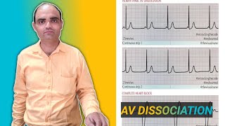 AV DISASSOCIATION IN HEART DISEASE BY DRSUMIT TYAGISUMITMEDICALDISPENSARY1 [upl. by Dewitt]