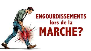 Des engourdissements lors de la MARCHE Infos et conseils [upl. by Pessa647]