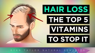 Top 5 Vitamins To PREVENT Hair Loss [upl. by Darach]