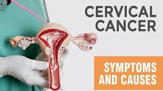 cervical cancer cancer mbbs doctor cervicalcancersymptoms medical medicalstudent [upl. by Zul]