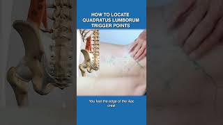 How To Locate Quadratus Lumborum Trigger Points [upl. by Alahcim172]