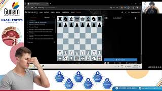 Learn to play chess in 30 days Day 8 [upl. by Ydnik]