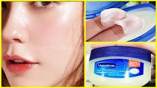 In 3 DAYS  Remove DARK SPOTS BLACK SPOTS With Vaseline  Amazing Vaseline Benefits For Darkspots [upl. by Bora]