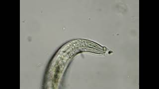 nematode eating a bacteria [upl. by Andros939]