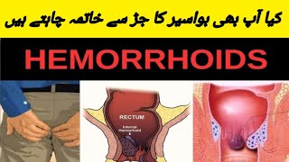 How To Get Rid Hemorrhoid [upl. by Daniele641]