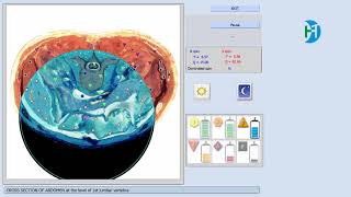 how to use 9d nls hunter quantum magnetic resonance analyzer [upl. by Pembroke]