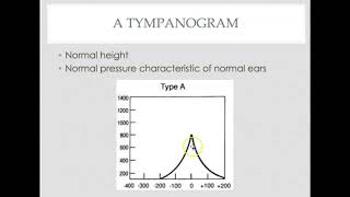 Tympanometry interpretation [upl. by Melena]