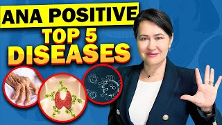 Top 5 Diseases with A Positive ANA Antinuclear Antibodies Test [upl. by Rednal694]