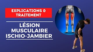 Optimiser la rééducation des lésions musculaires des ISCHIOJAMBIERS  Explications amp traitement [upl. by Juditha]