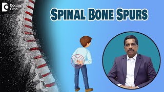 Spinal Bone Spurs  Symptoms amp Treatment Osteophytes  Dr Kodlady Surendra Shetty Doctors Circle [upl. by Ellekcir]