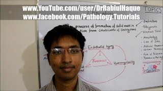 Thrombosis  Definition Pathogenesis Morphology amp Fate HD [upl. by Vlad]