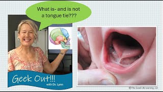 GEEKOUT What is and is not a tongue tie [upl. by Ytsirc]