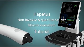 Hepatus 6 Ultrasound Operational Video [upl. by Consuelo]