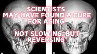 Scientists may have found a cure for aging [upl. by Ricoriki]