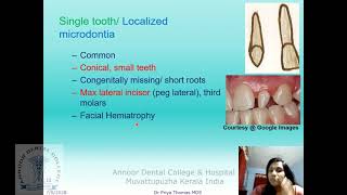 Development and Disturbances of Oral and Paraoral Structures [upl. by Halladba]