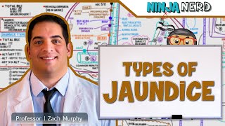 Gastrointestinal  Types of Jaundice [upl. by Chancelor]