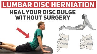 How to Heal Your Disc Herniation Without Surgery [upl. by Mikahs]