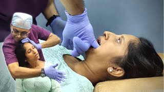 REVIVING Jaw Mobility  Chiropractic Care for Temporomandibular joint TMJ dysfunction [upl. by Anelis172]