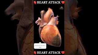 🫀Heart attack 💔 heart biology medical shorts nursingking [upl. by Marys]