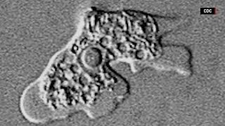 How dangerous are brain eating amoeba [upl. by Aramois257]